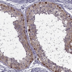 MAGEB1 Antibody, Novus Biologicals:Antibodies:Primary Antibodies
